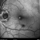 o01-ti01-22230-20090526-001