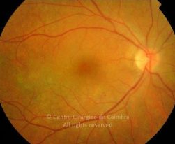 o01-ti02-17842-20060929-001