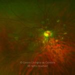 o01-ti02-2186527-20140620-005