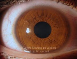 o01-ti12-2160217-20120426-001