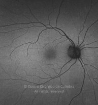 o01-ti15-2192880-20141209-001