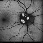 o01-ti15-4309-20100630-002