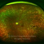 o02-ti02-1632-20120214-001