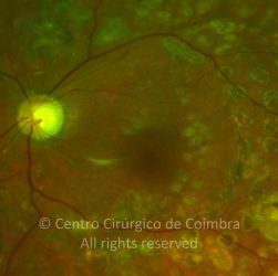 o02-ti02-1632-20120214-002