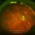 o02-ti02-2141135-20120418-999
