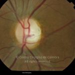 o02-ti02-2160217-20120426-004