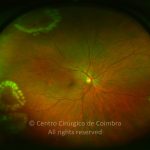 o02-ti02-5021-20120424-997