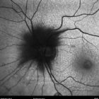 o02-ti15-114989-20110830-006
