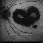 o02-ti15-2153030-20111026-005
