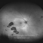 o02-ti15-2161125-20120511-993