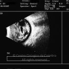 o02-ti23-2143812-20110301-002