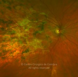 o03-ti02-12622-20110728-996