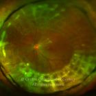 o03-ti02-2158655-20120404-994