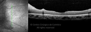 o03-ti03-117098-20140625-007