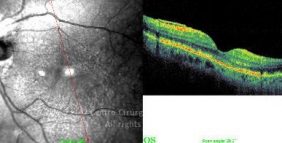o04-ti03-114989-20090406-002