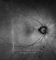 o04-ti15-2142578-20120417-003