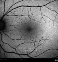o04-ti15-2144824-20110617-001