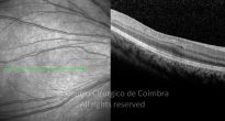 o05-ti03-2135967-20150205-012