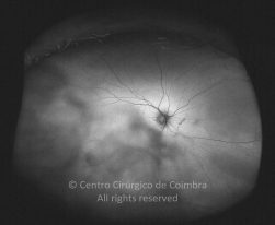 o05-ti15-5021-20120412-998
