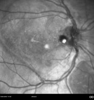 o05-ti16-2150201-20120316-003