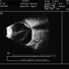 o05-ti23-2152581-20120102-004