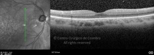 o06-ti03-132323-20111205-001