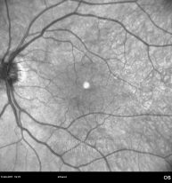 o06-ti16-2139940-20110412-003