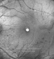 o07-ti01-2203607-20150703-002