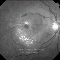 o07-ti02-8658-20060118-001