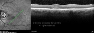 o07-ti03-22230-20120104-005