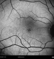 o07-ti15-130463-20101020-003