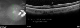 o08-ti03-132323-20111017-001