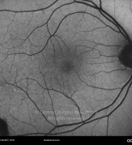 o09-ti15-2161125-20120511-003