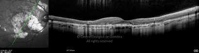 o10-ti03-7154-20110414-008