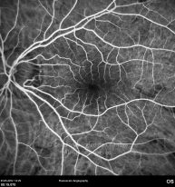 o10-ti07-18370-20120503-008
