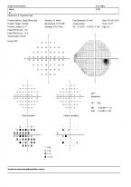 o10-ti13-2176110-20130809-001