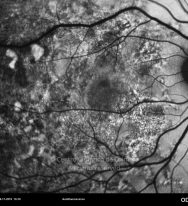 o10-ti15-12622-20101116-002