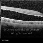 o11-ti03-2142183-20101217-001