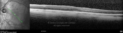 o11-ti03-2146813-20110621-007