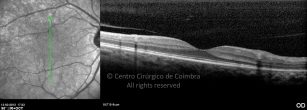 o11-ti03-2155735-20120313-007