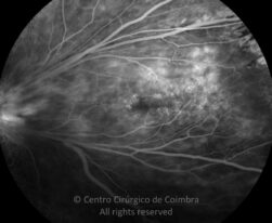 o11-ti07-2135967-20170116-009