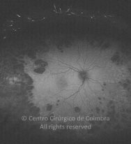 o13-ti15-2160392-20120515-992