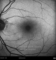 o13-ti15-9140-20110221-004