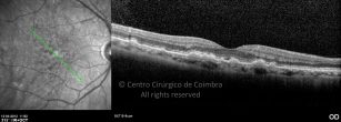 o15-ti03-2152149-20120412-011