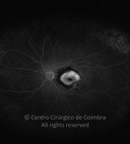 o18-ti07-2149219-20110705-002