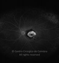 o18-ti07-2149219-20110705-002