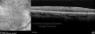 o19-ti03-115181-20120403-009