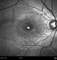 o20-ti01-2142183-20110826-022