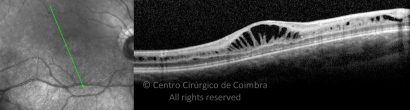 o25-ti03-130463-20100511-034