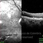 o26-ti03-119001-20090622-037